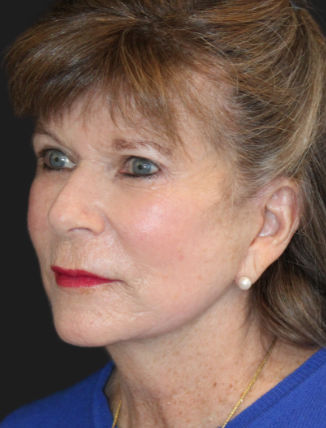 A woman with brown hair and pearl earrings is wearing a blue top and red lipstick, looking slightly to the right.