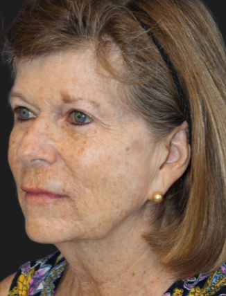 Older woman with short brown hair, wearing a black headband and a patterned top. She has a pearl earring and is looking to the side.