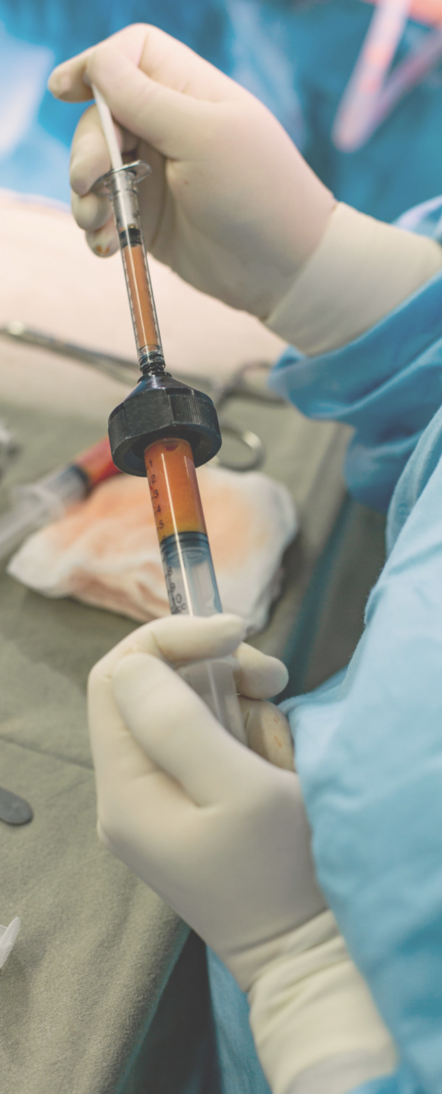 Medical professional in gloves handles a syringe and container filled with orange liquid during a procedure in a sterile environment.